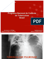 Aula Tuberculose 2023