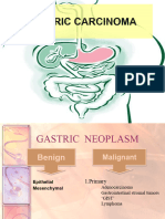 Gastric Carcinoma