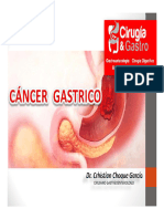 Cancer Gastrico