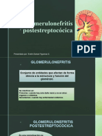 Glomerulonefritis Postestreptocócica