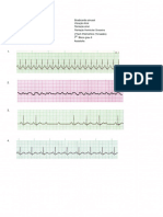 Acls - Análise de Ecg