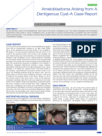 Ameloblastoma Arising in The Wall of Dentigerous Cyst - A Case Report