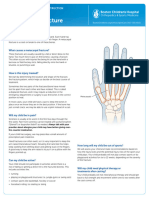 Metacarpal Fracture Guide