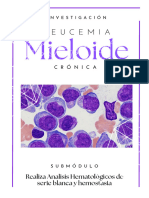 Leucemia Mielocítica Cronica