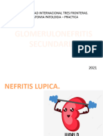 Glomerulonefritis Secundaria 2021