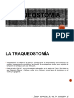 Traqueostomia