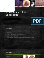 Diseases of Esophagus