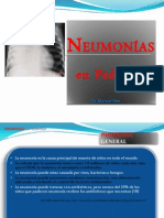 Neumonias en Pediatria