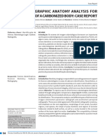 Dental Radiographic Anatomy Analysis For Identification of A Carbonized Body: Case Report