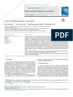 A Rare Nasal Fibrosarcoma A Case 2024 International Journal of Surgery Case