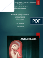 ANENCEFALIA02