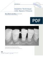 03 - Modified Grassline Technique For Orthodontic Space Closure