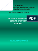 Incisor Guidance