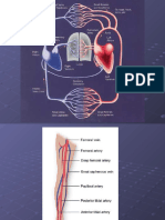 Arterial Stenosis or Occlusion