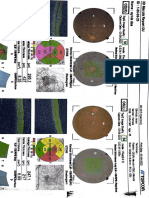 Retina Scan Report