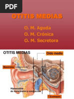 Otitis y Mastoiditis