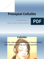 Preseptal Cellulitis: Prepared By: Junior Intern Charles Nicole P. Alonzo