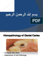 2histopathology of Dental Caries 2