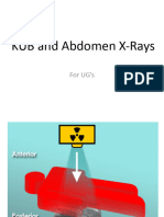 Abd Xray