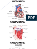 FR Valvulopatia Mitral