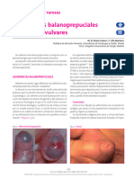 Adherencias Balanoprepuciales