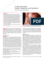 SCMS V34i4 White Lesions in The Oral Cavity