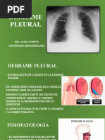 Derrame Pleural