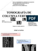 Columna Vertebral