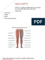 Prevention of DVT