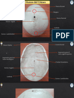 Imagenes Cabeza y Cuello Rotuladas Corregida (1) - 1-17