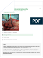 Pós-Teste Da Aula - Hemorragias Da Segunda Metade Da Gestação