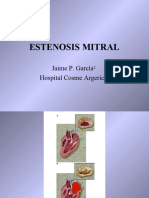 Estenosis Mitral.