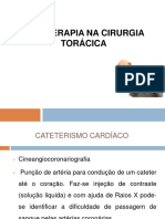 Aula - Fisioterapia Na Cirurgia Torácica