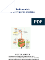 L'ulcère Gastro-Duodénal