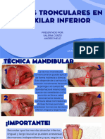 Técnicas Tronculares Mandíbula Valec y Melo