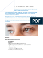 Explains Keratitis - An Inflammation of The Cornea