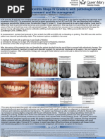 J Bayliss Chapman POSTER - Molar-Incisor Periodontitis Stage IV Grade C Associated With Pathologic Tooth Movement