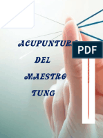 Acupuntura Tung