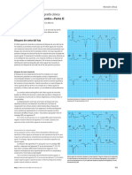 ABC of Clinical Electrocardiography Acute Myocardial Infarction-Part II - En.es