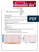 Interpretacion Ekg Lesly