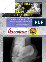 Clase de Fracturas de Calcaneo y Astragalo