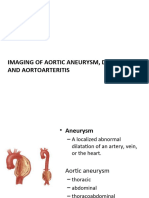 Aortic Aneurysm Aorto-Arteritis