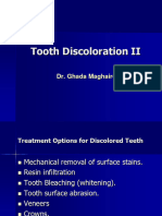 Tooth Discoloration Part II