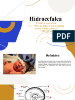 HIDROCEFALIA