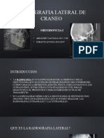 Radiografia Lateral de Craneo