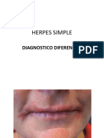 Varicela y Herpes Zoster