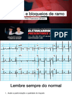 Curso ECG Bloqueios e Arritmias