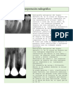 Radiografia Endo