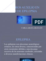 Epilepsia