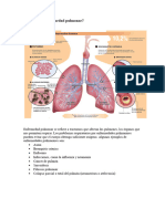 Enfermedades Pulmonares